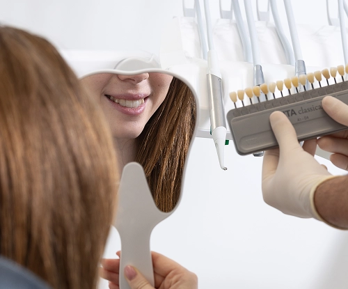 Blanqueamiento dental 1